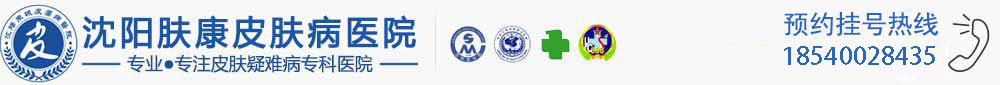 沈阳皮肤病医院_辽宁沈阳肤康医院皮肤科_沈阳皮肤病医院哪家好